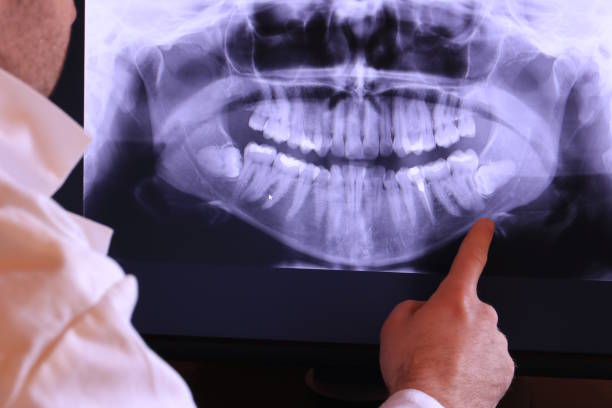 Best Emergency Dental Care for Broken or Chipped Teeth in White Bluff, TN