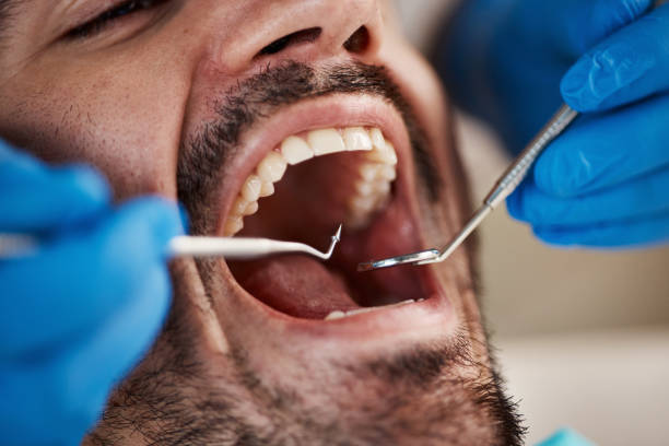 Best Emergency Tooth Extraction in White Bluff, TN